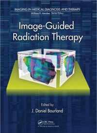 Image-Guided Radiation Therapy