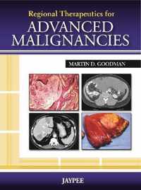 Regional Therapeutics for Advanced Malignancies