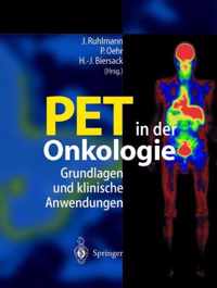 Pet in Der Onkologie