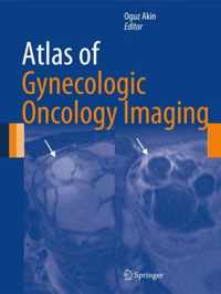 Atlas of Gynecologic Oncology Imaging