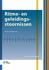 Ritme- en geleidingsstoornissen