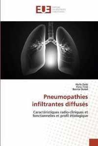 Pneumopathies infiltrantes diffuses