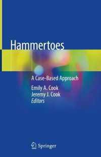 Hammertoes