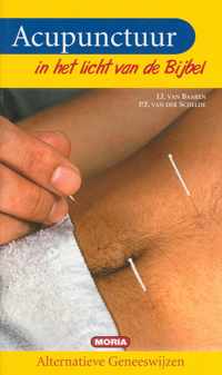 Acupunctuur