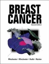 Breast Cancer