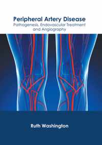 Peripheral Artery Disease