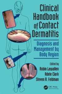 Clinical Handbook of Contact Dermatitis