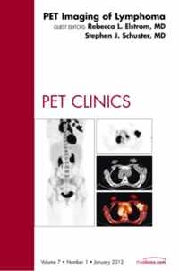 PET Imaging of Lymphoma, An Issue of PET Clinics