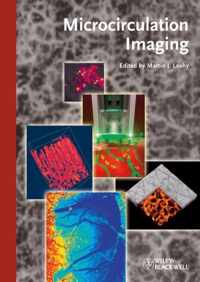 Microcirculation Imaging