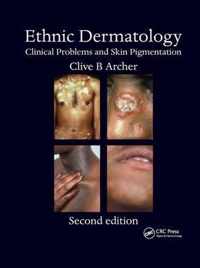 Ethnic Dermatology: Clinical Problems and Skin Pigmentation