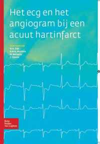 Het ECG en het angiogram bij een acuut hartinfarct