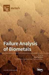Failure Analysis of Biometals
