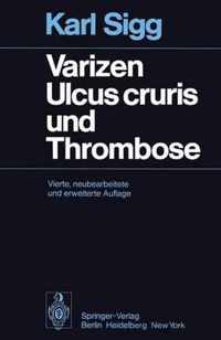 Varizen, Ulcus Cruris Und Thrombose