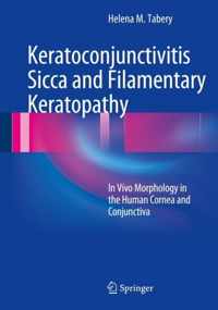 Keratoconjunctivitis Sicca and Filamentary Keratopathy