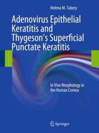 Adenovirus Epithelial Keratitis and Thygeson s Superficial Punctate Keratitis