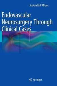 Endovascular Neurosurgery Through Clinical Cases