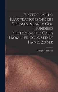 Photographic Illustrations of Skin Diseases, Nearly One Hundred Photographic Cases From Life, Colored by Hand. 2d Ser