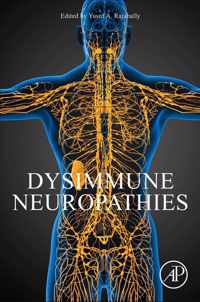 Dysimmune Neuropathies