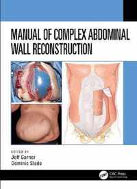 Manual of Complex Abdominal Wall Reconstruction