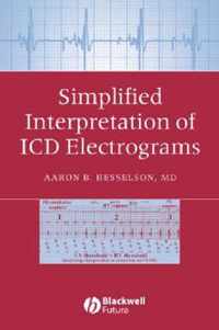 Simplified Interpretation of ICD Electrograms