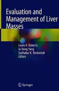 Evaluation and Management of Liver Masses