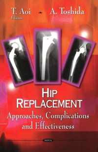 Hip Replacement