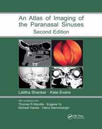 Atlas of Imaging of the Paranasal Sinuses, Second Edition