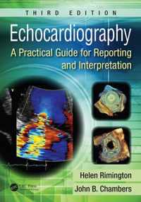 Echocardiography