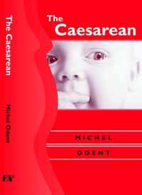 The Caesarean