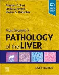 MacSween's Pathology of the Liver