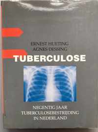 TUBERCULOSE