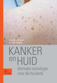 Kanker En Huid