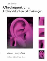 Ohrakupunktur bei Orthopadischen Erkrankungen