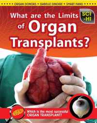 What Are the Limits of Organ Transplantation?