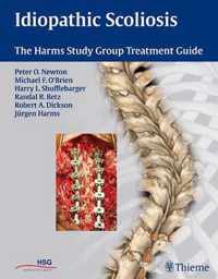 Idiopathic Scoliosis