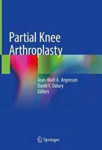 Partial Knee Arthroplasty