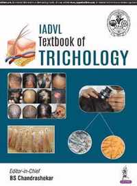 IADVL Textbook of Trichology