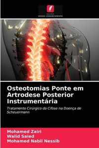 Osteotomias Ponte em Artrodese Posterior Instrumentaria