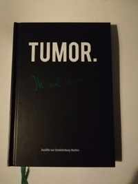 Tumor. Ik wil leven!