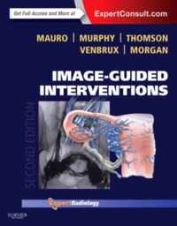 Image-Guided Interventions