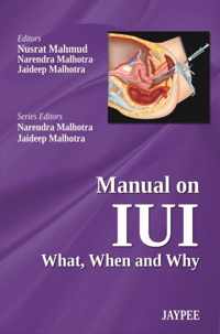 Manual on IUI