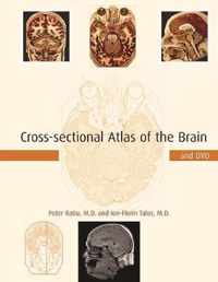 Cross-sectional Atlas of the Brain and DVD