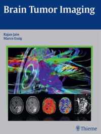 Brain Tumor Imaging