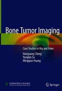 Bone Tumor Imaging