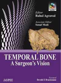 Temporal Bone