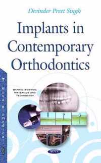 Implants in Contemporary Orthodontics