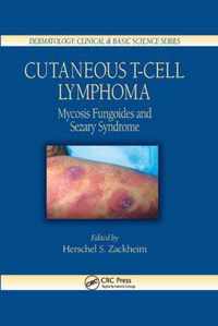 Cutaneous T-Cell Lymphoma