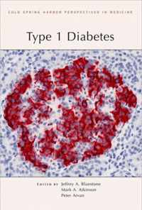 Type 1 Diabetes