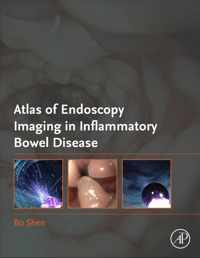 Atlas of Endoscopy Imaging in Inflammatory Bowel Disease