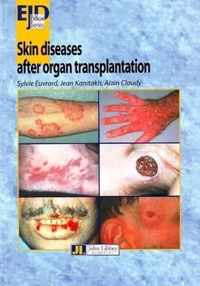 Skin Diseases After Organ Transplantation